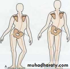 CEREBRAL PALSY