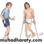 CEREBRAL PALSY