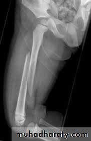 Lower limb