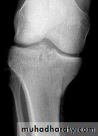 Lower limb