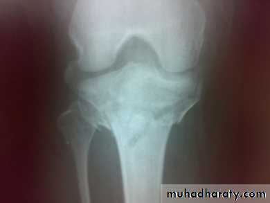 Lower limb