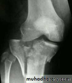 Lower limb