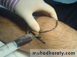 Lower limb