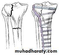 Lower limb