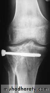 Lower limb