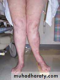 Lower limb