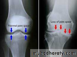 Lower limb