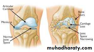 Lower limb