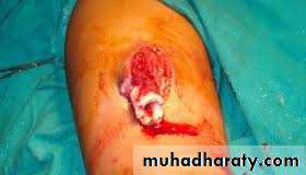 Lower limb