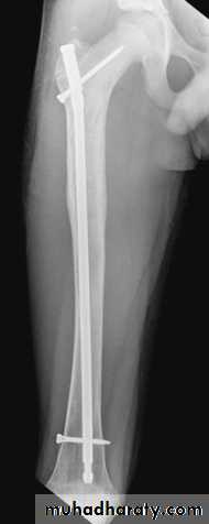 Lower limb
