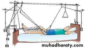 Lower limb