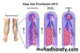 Lower limb