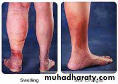 Lower limb