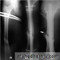 Lower limb