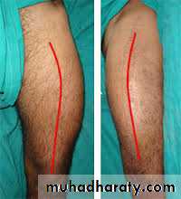 Lower limb