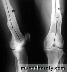 Lower limb