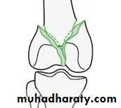 Lower limb