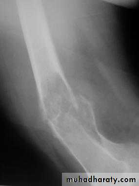 Lower limb