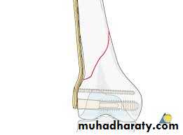 Lower limb