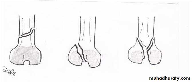 Lower limb