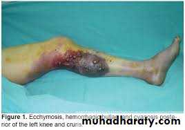 Lower limb