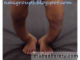 Lower limb