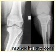 Lower limb