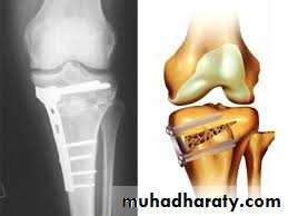 Lower limb