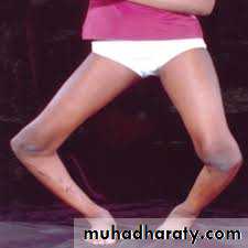 Lower limb