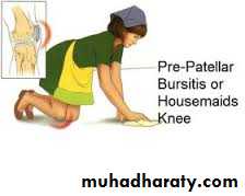 Lower limb