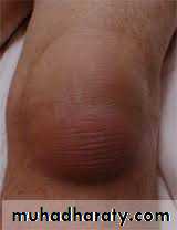 Lower limb