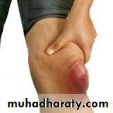 Lower limb