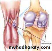 Lower limb