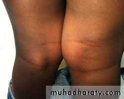 Lower limb