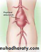 Lower limb