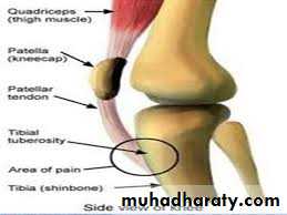 Lower limb