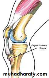 Lower limb