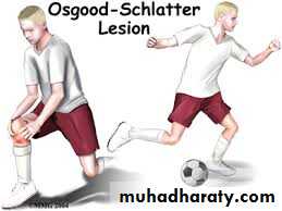 Lower limb