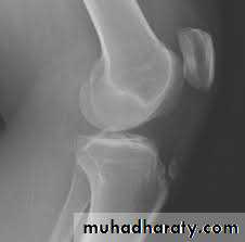 Lower limb