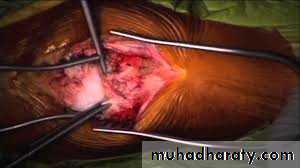 Lower limb