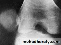 Lower limb
