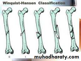 Lower limb