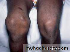 Lower limb