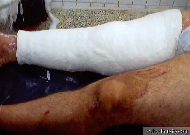 Lower limb