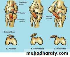 Lower limb