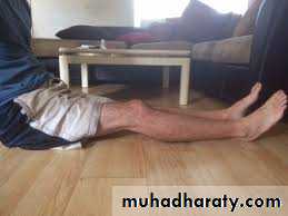 Lower limb