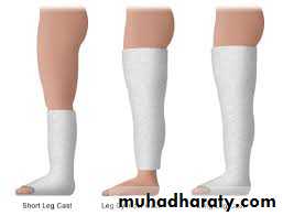 Lower limb