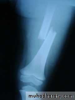 Lower limb