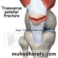 Lower limb