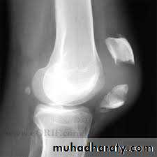 Lower limb